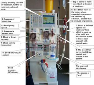 Dialysis Machine